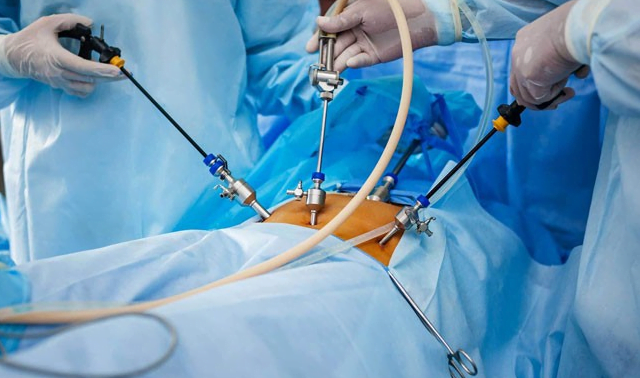 روش لاپاراسکوپی در میان روش های جراحی چاقی چه مزیتی نسبت به بقیه روش های جراحی دارد؟