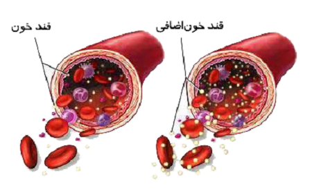 عامل اصلی افت قند خون نوسانات شدید میزان قند در بدن می‌باشد